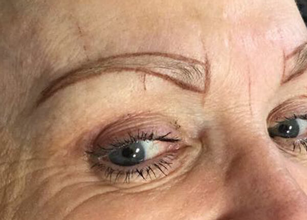 Eyebrow During Phibrow Application